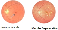 Yellow Spot Disease