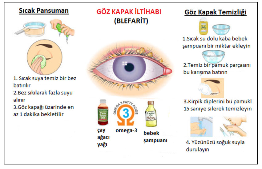 sıcak pansuman nasıl yapılır