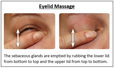 Blepharitis (Eyelid Inflammation)