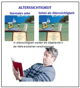 Alterssichtigkeit