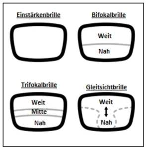 Alterssichtigkeit