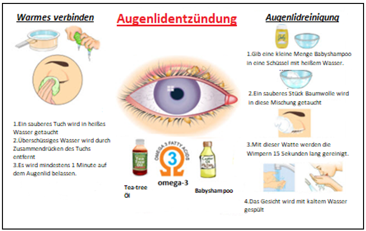 Blepharitis (Augenlidentzündung)