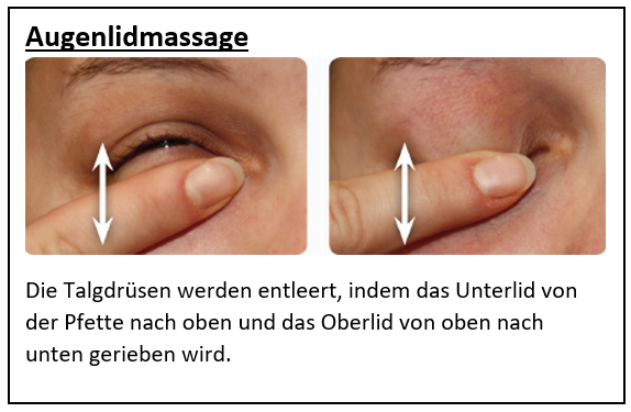 Blepharitis (Augenlidentzündung)