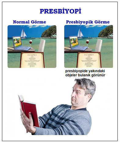 Presbiyopi