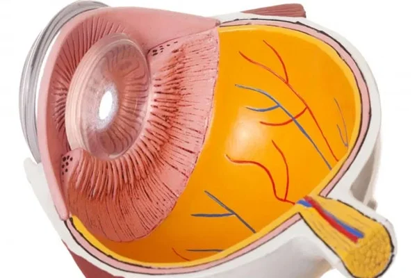 Santral Seröz Retinopati