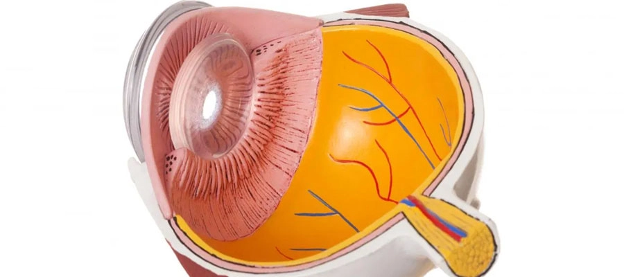 Santral Seröz Retinopati