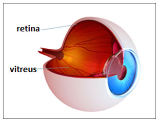 Vitrektomi