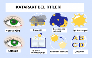 Katarakt Ameliyatı