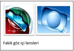 Lasik Göz Ameliyatı