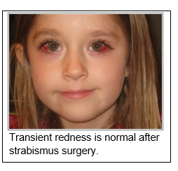 Strabismus Surgery