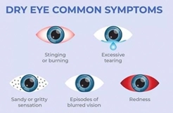 Dry Eyes