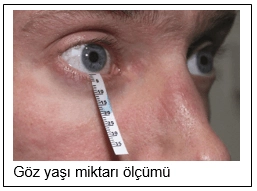 Göz Kuruluğu