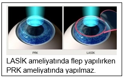 Excimer Lazer Ameliyatı