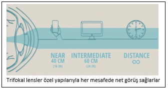Göz İçi Lensler