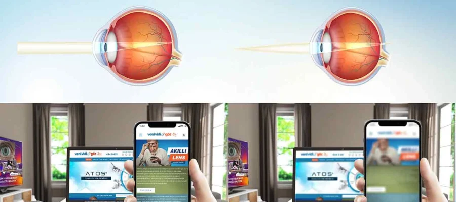 Hipermetrop Nedir? Yakın Görme Sorunları Nasıl Anlaşılır?