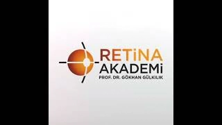 Akıllı Lens