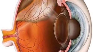 retina-dekolmanı_2026