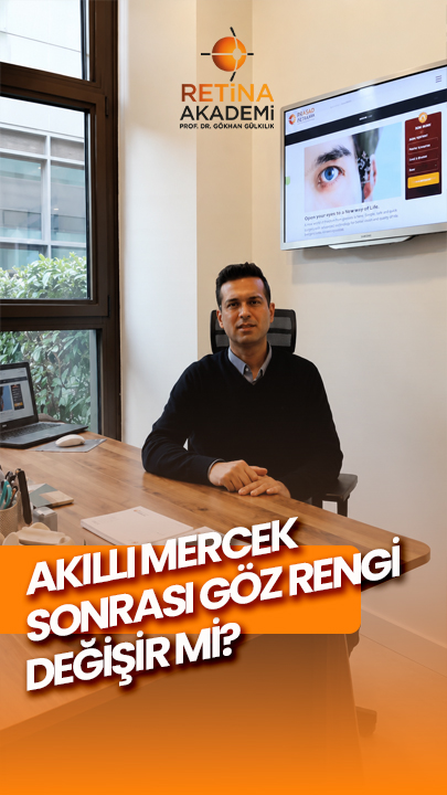 akıllı-mercek-sonrası-göz-rengi-değişir-mi.jpg